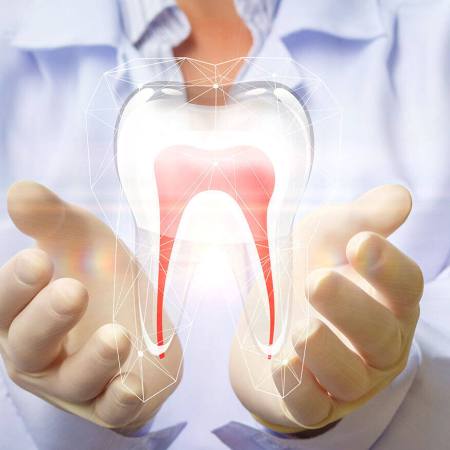 Root Canal Treatment | Tower House Dental Clinic